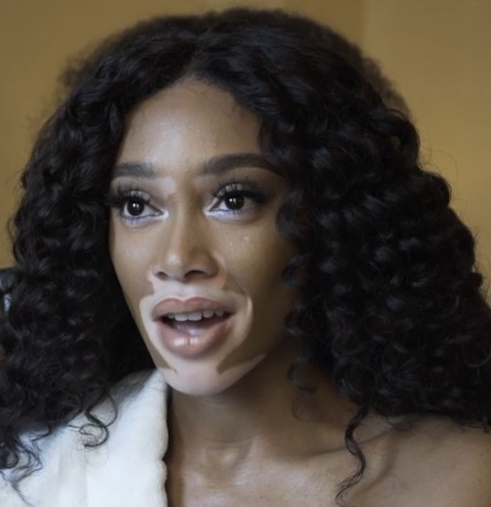 Winnie Harlow Height, Weight, Measurements, Eye Color, Biography